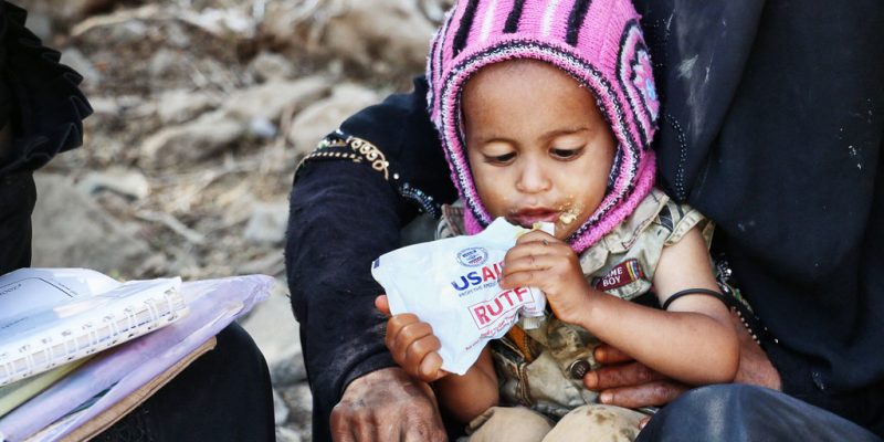 A child in Yemen eats a ready-to-use therapeutic food bag